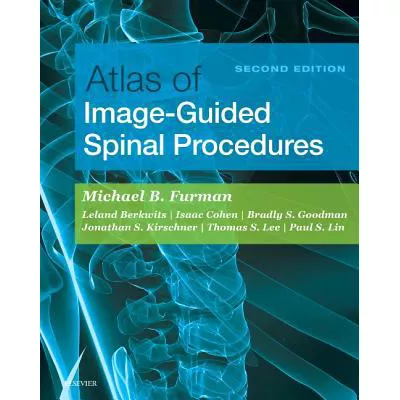Atlas of Image-Guided Spinal Procedures E-Book : Atlas of Image-Guided Spinal Procedures E-Book