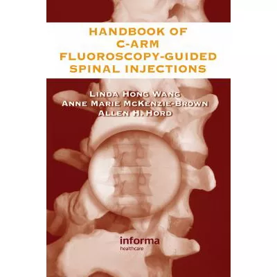 Handbook of C-Arm Fluoroscopy-Guided Spinal Injections